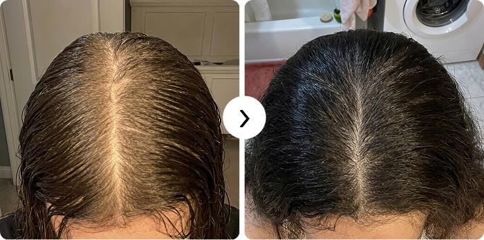 Repousse des cheveux avant et après