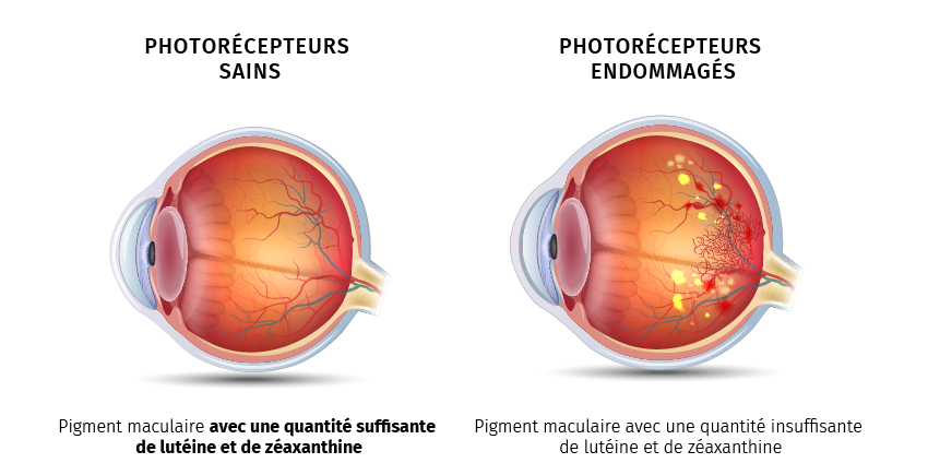 Eye PROtect